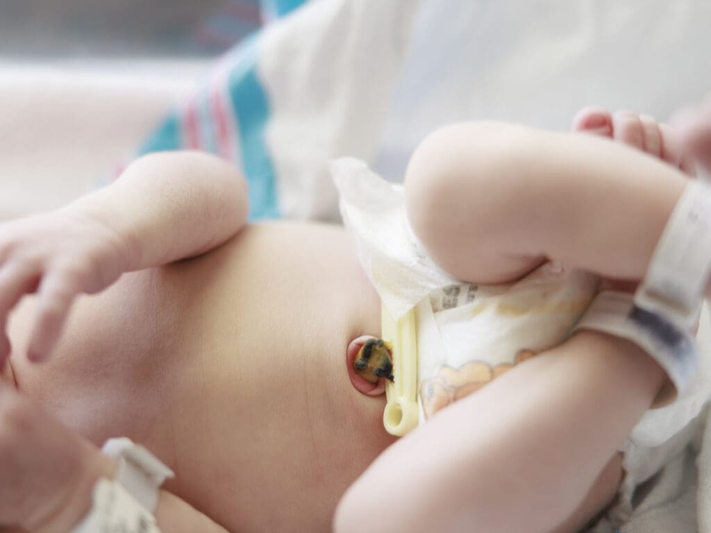Newborn baby torso with umbilical cord showing in Fresh 48 photography session.
